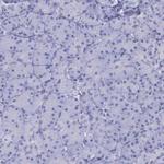 alpha Galactosidase Antibody in Immunohistochemistry (Paraffin) (IHC (P))