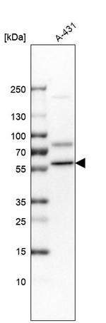 DKC1 Antibody in Western Blot (WB)