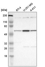 DKC1 Antibody in Western Blot (WB)