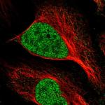 MNAT1 Polyclonal Antibody