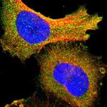 PI3K p85 alpha Polyclonal Antibody