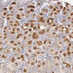 PI3K p85 alpha Antibody in Immunohistochemistry (Paraffin) (IHC (P))
