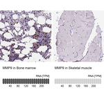MMP9 Antibody in Immunohistochemistry (Paraffin) (IHC (P))