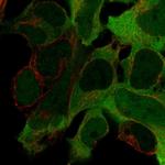 Creatine Kinase BB Polyclonal Antibody