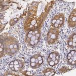 Creatine Kinase BB Antibody in Immunohistochemistry (Paraffin) (IHC (P))
