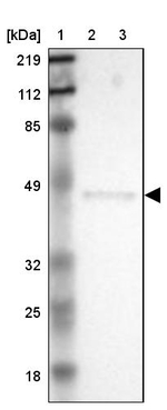 ERP44 Antibody in Western Blot (WB)