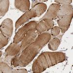 FHL1 Antibody in Immunohistochemistry (Paraffin) (IHC (P))