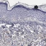 FHL1 Antibody in Immunohistochemistry (Paraffin) (IHC (P))