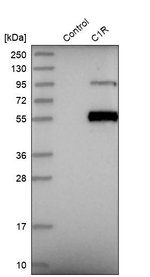 C1r Antibody in Western Blot (WB)