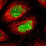 ATF3 Polyclonal Antibody