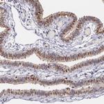 ATF3 Antibody in Immunohistochemistry (Paraffin) (IHC (P))