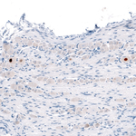 ATF3 Antibody in Immunohistochemistry (Paraffin) (IHC (P))