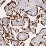 ATF3 Antibody in Immunohistochemistry (Paraffin) (IHC (P))
