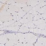 ATF3 Antibody in Immunohistochemistry (Paraffin) (IHC (P))