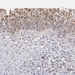 ATF3 Antibody in Immunohistochemistry (Paraffin) (IHC (P))