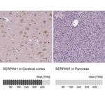 Neuroserpin Antibody in Immunohistochemistry (Paraffin) (IHC (P))