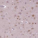 Neuroserpin Antibody in Immunohistochemistry (Paraffin) (IHC (P))