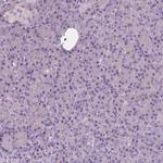 Neuroserpin Antibody in Immunohistochemistry (Paraffin) (IHC (P))