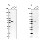 UPF3B Antibody in Western Blot (WB)
