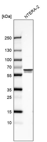 UPF3B Antibody in Western Blot (WB)