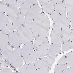 ELF1 Antibody in Immunohistochemistry (Paraffin) (IHC (P))
