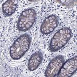 P-cadherin Antibody in Immunohistochemistry (Paraffin) (IHC (P))