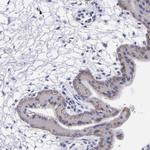 P-cadherin Antibody in Immunohistochemistry (Paraffin) (IHC (P))