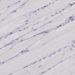 P-cadherin Antibody in Immunohistochemistry (Paraffin) (IHC (P))