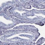 Factor XIII A Antibody in Immunohistochemistry (Paraffin) (IHC (P))