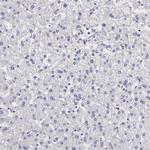 Factor XIII A Antibody in Immunohistochemistry (Paraffin) (IHC (P))