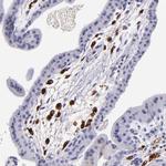 Factor XIII A Antibody in Immunohistochemistry (Paraffin) (IHC (P))