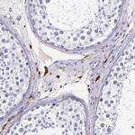Factor XIII A Antibody in Immunohistochemistry (Paraffin) (IHC (P))