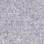 APOBEC3G Antibody in Immunohistochemistry (Paraffin) (IHC (P))