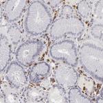 APOBEC3G Antibody in Immunohistochemistry (Paraffin) (IHC (P))