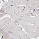 DIABLO Antibody in Immunohistochemistry (Paraffin) (IHC (P))