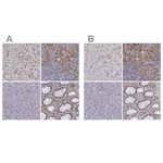 CD14 Antibody in Immunohistochemistry (Paraffin) (IHC (P))