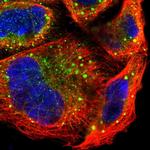 PREX1 Polyclonal Antibody