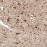 PREX1 Antibody in Immunohistochemistry (Paraffin) (IHC (P))