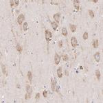 PREX1 Antibody in Immunohistochemistry (Paraffin) (IHC (P))