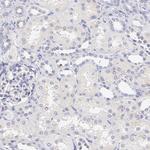 PREX1 Antibody in Immunohistochemistry (Paraffin) (IHC (P))