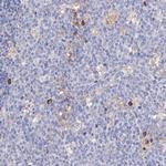 PREX1 Antibody in Immunohistochemistry (Paraffin) (IHC (P))