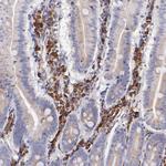 PREX1 Antibody in Immunohistochemistry (Paraffin) (IHC (P))