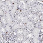 WASP Antibody in Immunohistochemistry (Paraffin) (IHC (P))