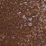 WASP Antibody in Immunohistochemistry (Paraffin) (IHC (P))