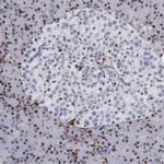 WASP Antibody in Immunohistochemistry (Paraffin) (IHC (P))