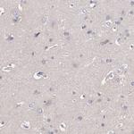 MBL2 Antibody in Immunohistochemistry (Paraffin) (IHC (P))