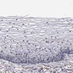 MBL2 Antibody in Immunohistochemistry (Paraffin) (IHC (P))