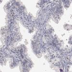 MBL2 Antibody in Immunohistochemistry (Paraffin) (IHC (P))