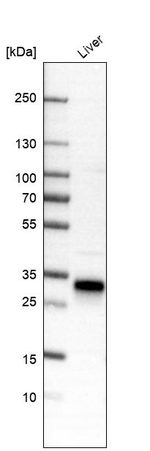 MBL2 Antibody in Western Blot (WB)