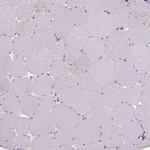 VWF Polyclonal Antibody